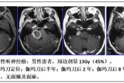 天坛医院美容科水光针怎么样